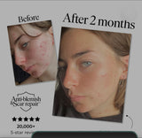 47 Skin Daily SPF 30 - Anti-blemish & Scar Repair Sunscreen with Silver Chitoderm